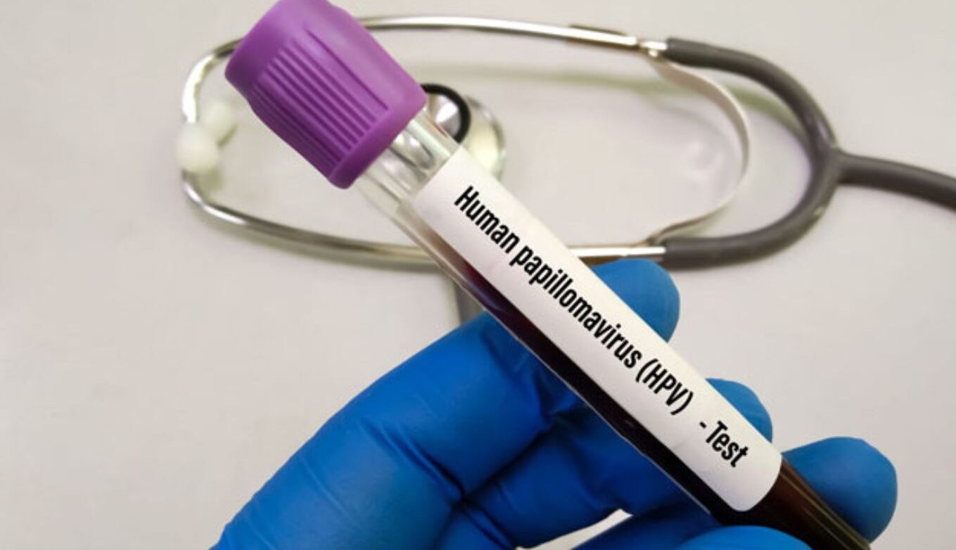 virus-papiloma-humano