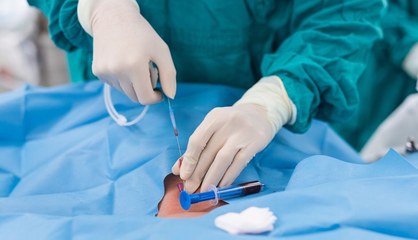 radiosologia vascular, servei, rvi, beneficios