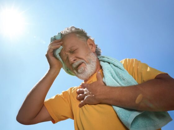 golpe de calor